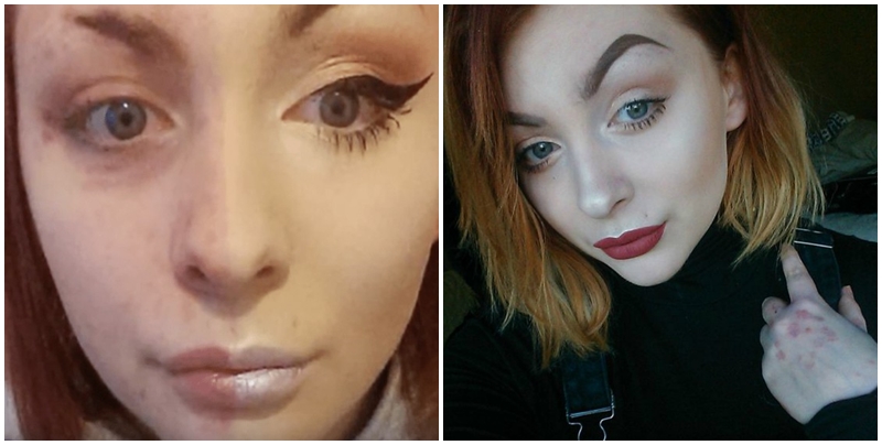 Přítel ji urazil, když viděl její tvář. Dívka teď válcuje internet