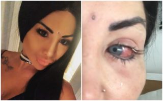 Modelka toužila změnit barvu svých očí: Skončila téměř slepá!