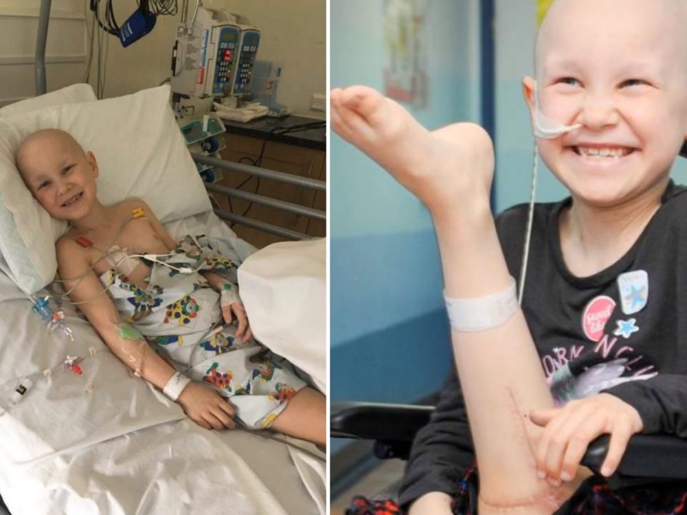 GALERIE: Lékaři přišili dívce nohu obráceně. Má to však svůj důvod