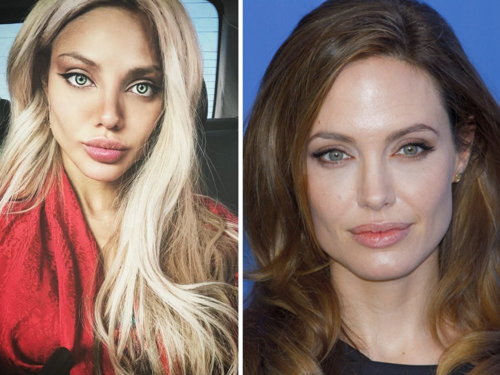 FOTO: Žena chtěla vypadat jako Angelina Jolie. Dopadla ale jako Michael Jackson!
