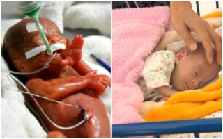 FOTO: Kristýnka přišla na&nbsp;svět předčasně s&nbsp;váhou 322 gramů! Díky lékařům je v&nbsp;pořádku