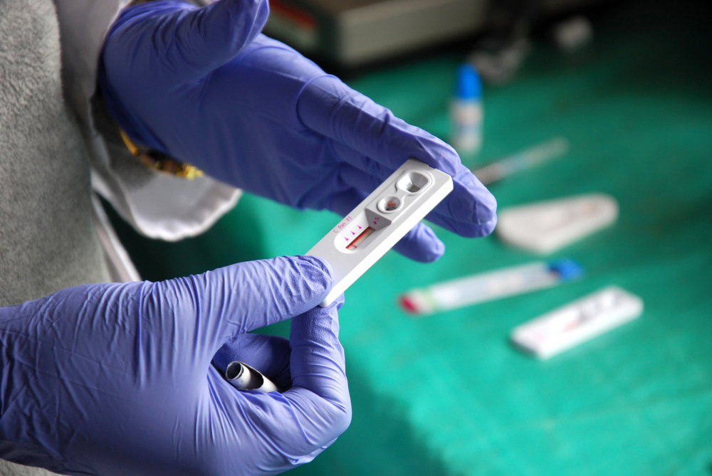 Historický průlom? Vědci z&nbsp;Hongkongu možná vědí, jak léčit AIDS