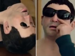 FOTO: Pobyt na&nbsp;slunci ho může i&nbsp;zabít. Muž musí nosit masku svého obličeje