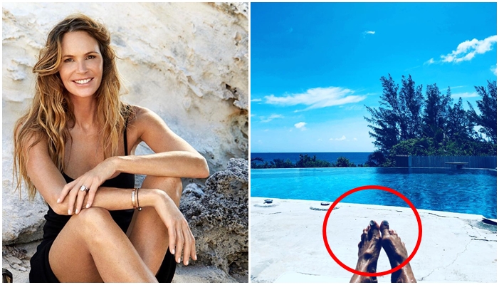 FOTO: Co to má s&nbsp;nohama? Tohle s&nbsp;vámi udělají roky modelingu