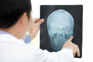 Chybná diagnóza lékařů málem stála dívku (8) život. Proč bylo holčičce špatně?