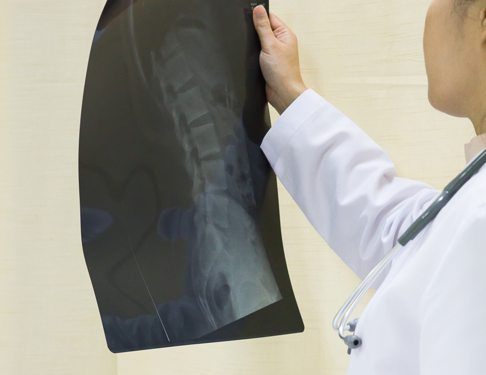 Žena šla k lékaři kvůli bolestem v nohách. Diagnóza byla překvapivá