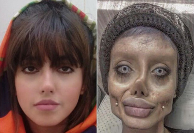 FOTO: Zombie nebo Angelina Jolie? Fanynka chce vypadat jako slavná herečka
