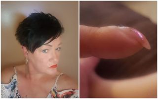 Žena zveřejnila FOTKU svých nehtů: Přátelé ji upozornili na&nbsp;vážnou diagnózu