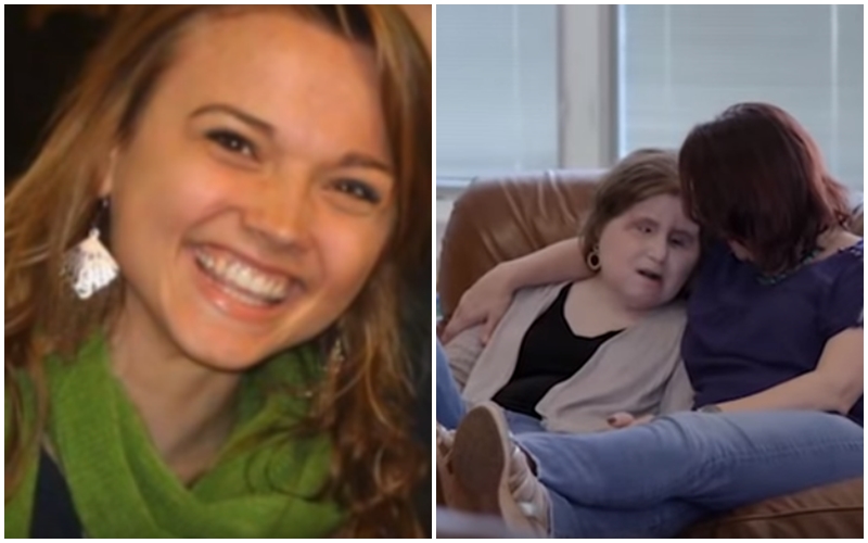 FOTO: Dívka (21) si ustřelila obličej! Po&nbsp;transplantaci může zase dýchat a&nbsp;jíst