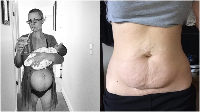 GALERIE: Žádné přikrášlování! I&nbsp;takto vypadají ženy po&nbsp;porodu