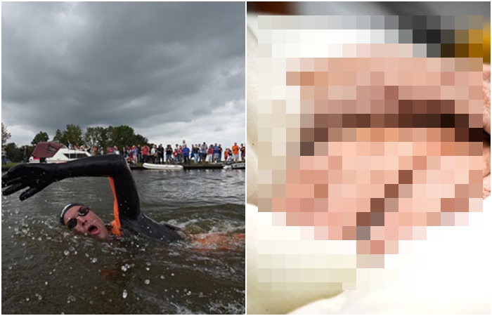 FOTO: Mladík uplaval 163 kilometrů v kuse. Neuvěříte, jak vypadaly jeho ruce!