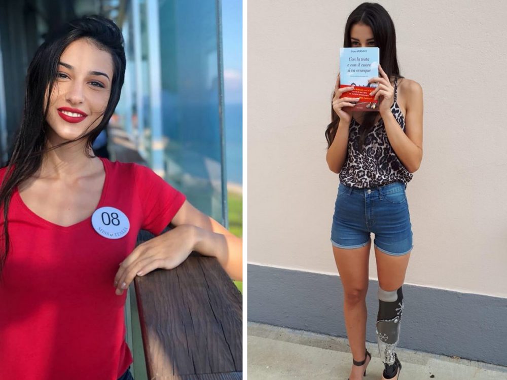 I přes handicap si splnila sen! Dívka se dostala až do finále soutěže krásy
