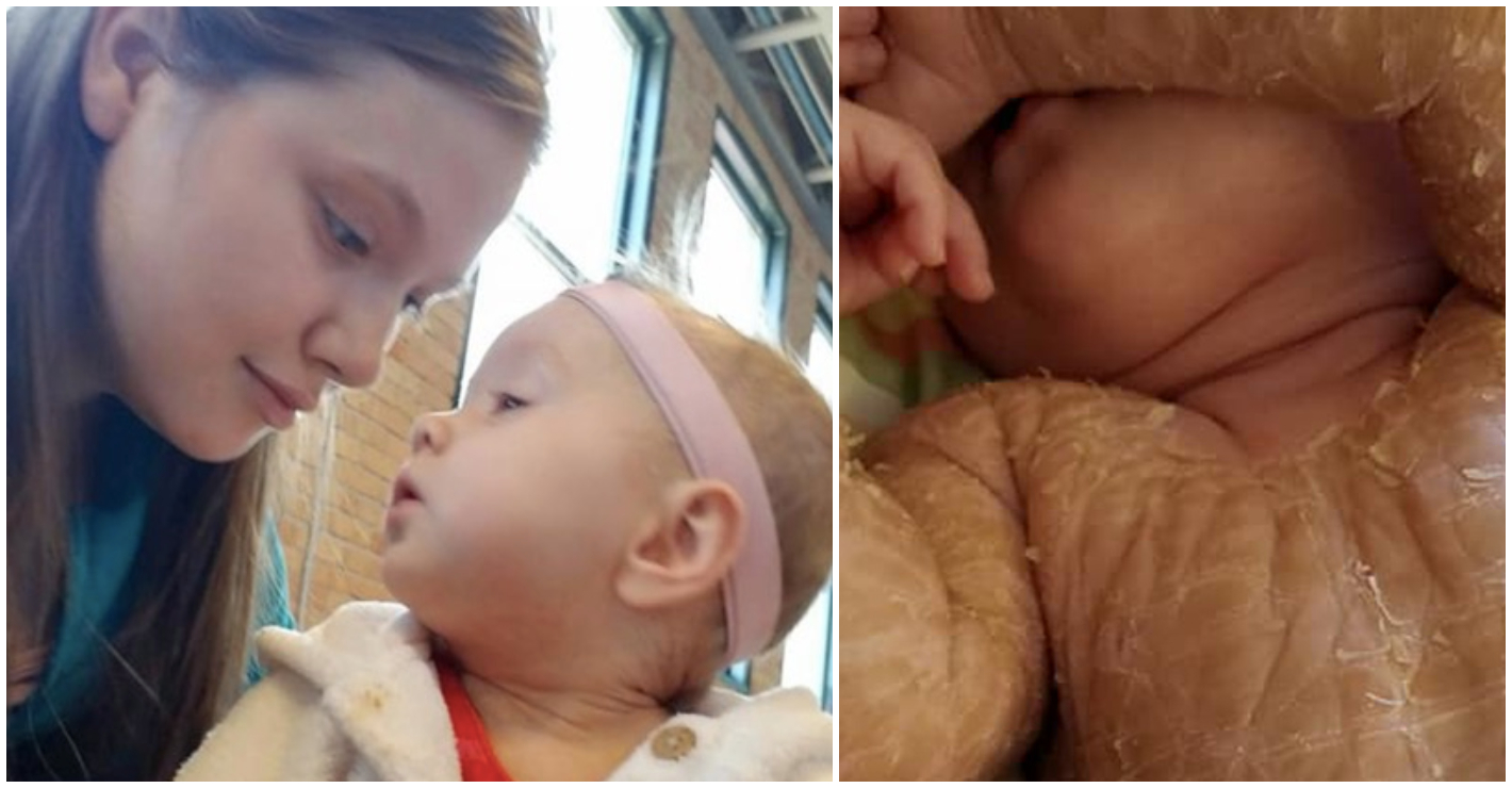 Matka čelí kritice kvůli koupání dcery v bělidle. Proč to dělá?