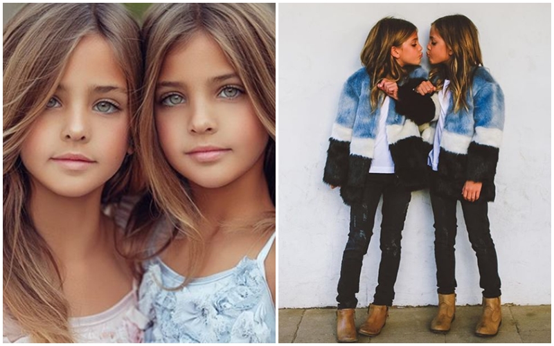 GALERIE: Jsou tohle nejkrásnější dvojčata na&nbsp;světě? Internet je miluje!