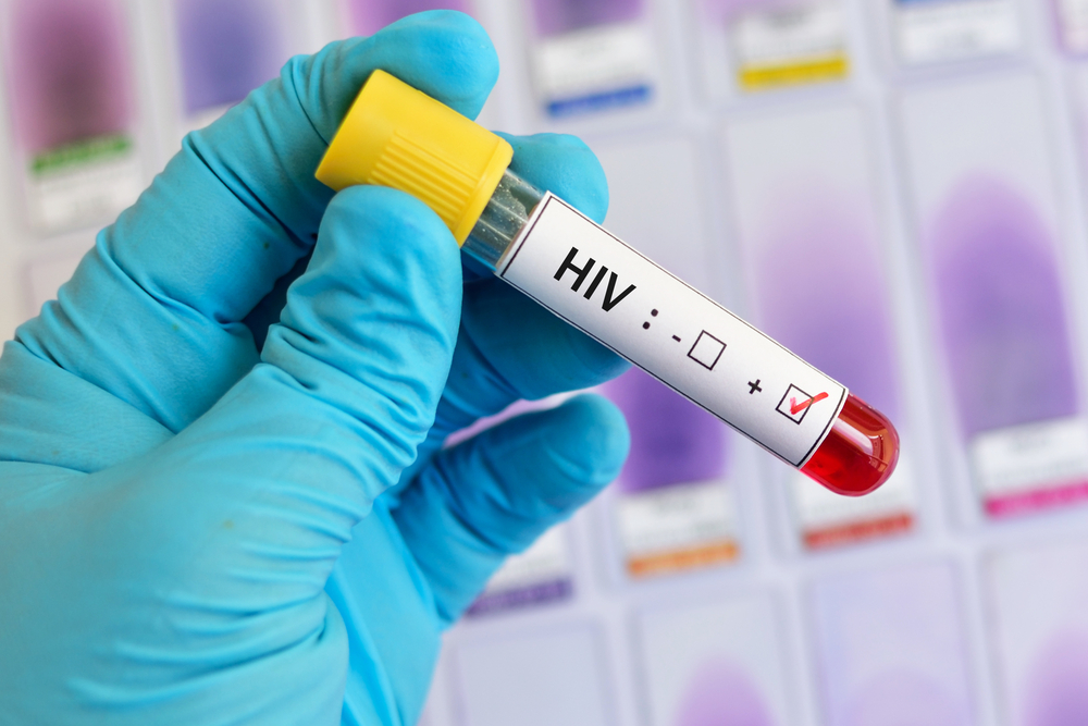 Mladík se snažil nakazit ženy HIV, žádná naštěstí virus nechytla. Od soudu odešel s podmínkou