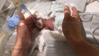FOTO: Nejmenší chlapeček na&nbsp;světě vážil pouze 268 gramů! Po&nbsp;půl roce už je konečně doma