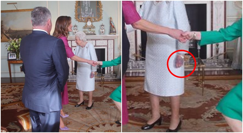 Ruce britské královny Alžběty jsou fialové! Hrozí jí nebezpečí?