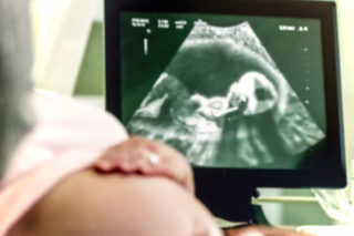 Budoucí otec naštval svou ženu během ultrazvuku: Kvůli tomuhle s&nbsp;ním dva dny nemluvila