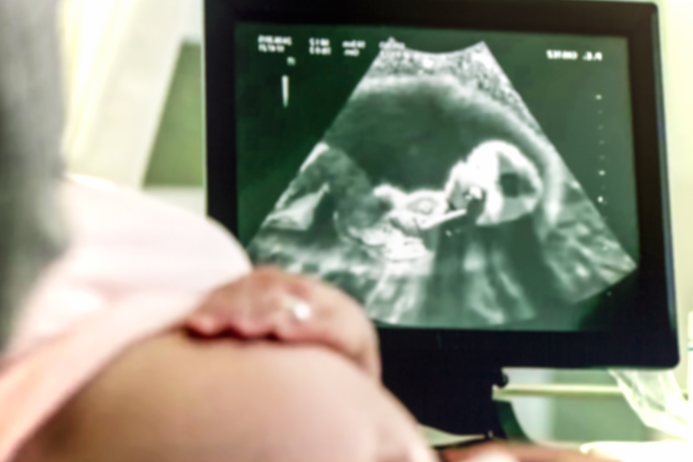 Budoucí otec naštval svou ženu během ultrazvuku: Kvůli tomuhle s ním dva dny nemluvila