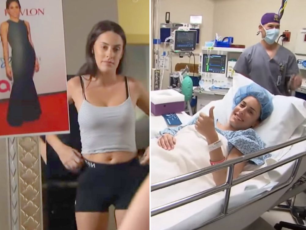 Žena chtěla vypadat jako Meghan Markle! Rozhodla se proto pro&nbsp;operaci