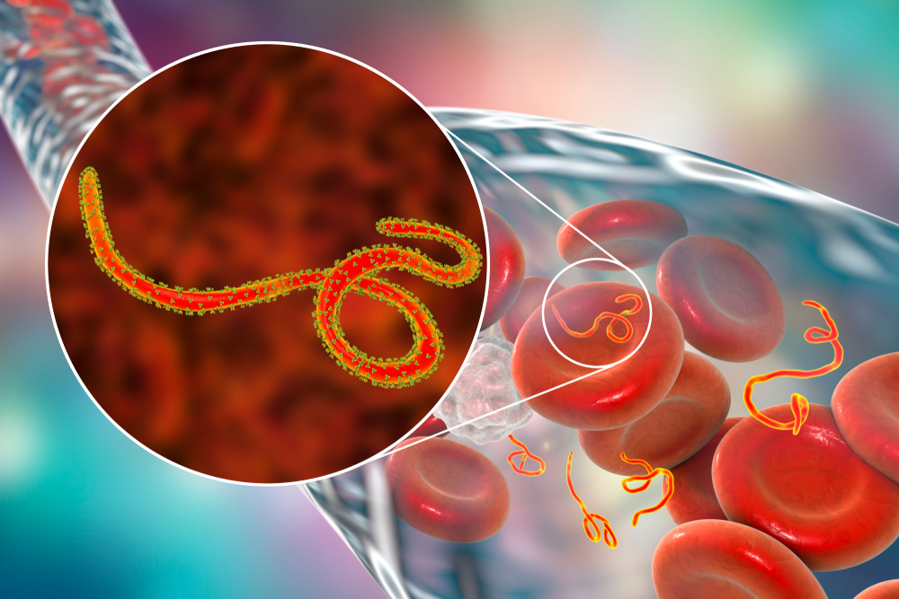 Válka s ebolou: V Ugandě začne největší test experimentální vakcíny