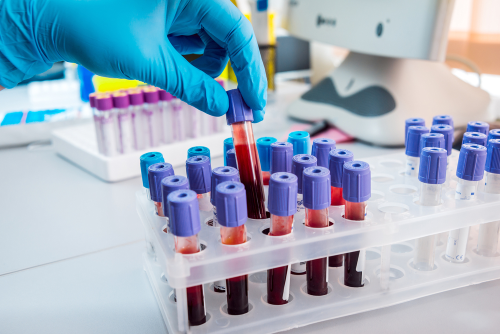 Britští vědci vyvinuli test, který určí koronavirus do pěti minut