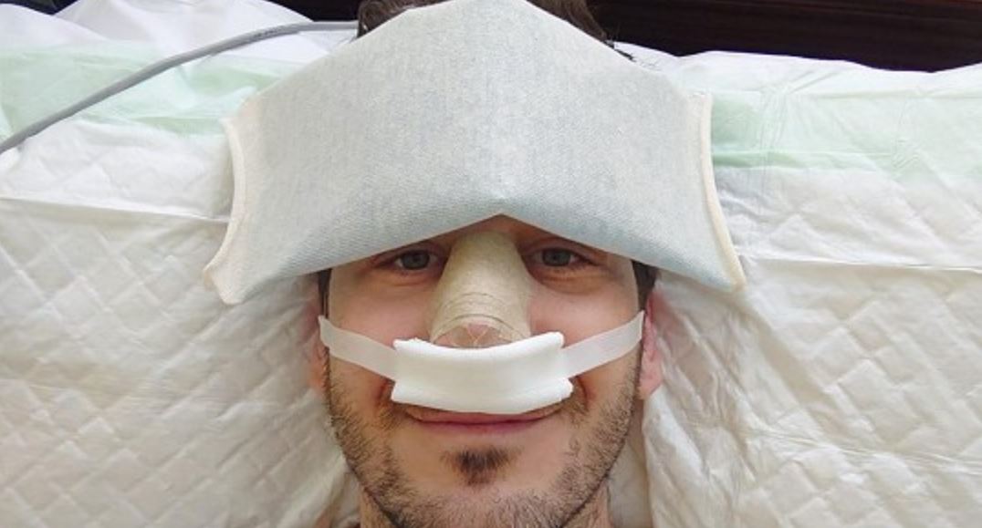Před svatbou se »nechal vylepšit«: Moderátor Evropy 2 popsal, proč se rozhodl pro&nbsp;plastickou operaci