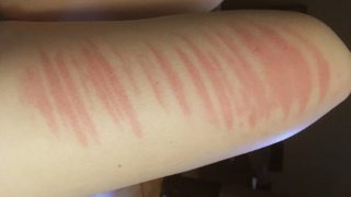 GALERIE: Několik příkladů toho, co vám mohou způsobit roztrhané džíny v&nbsp;létě
