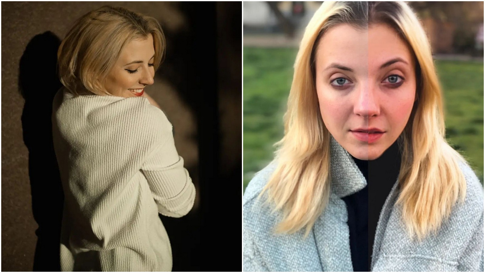 Anička Slováčková vyzvala ženy, aby měly rády samy sebe. Krása nepotřebuje filtr, zdůraznila