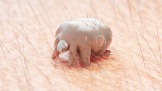 Svrab se šíří Českem. Nakazit se může každý