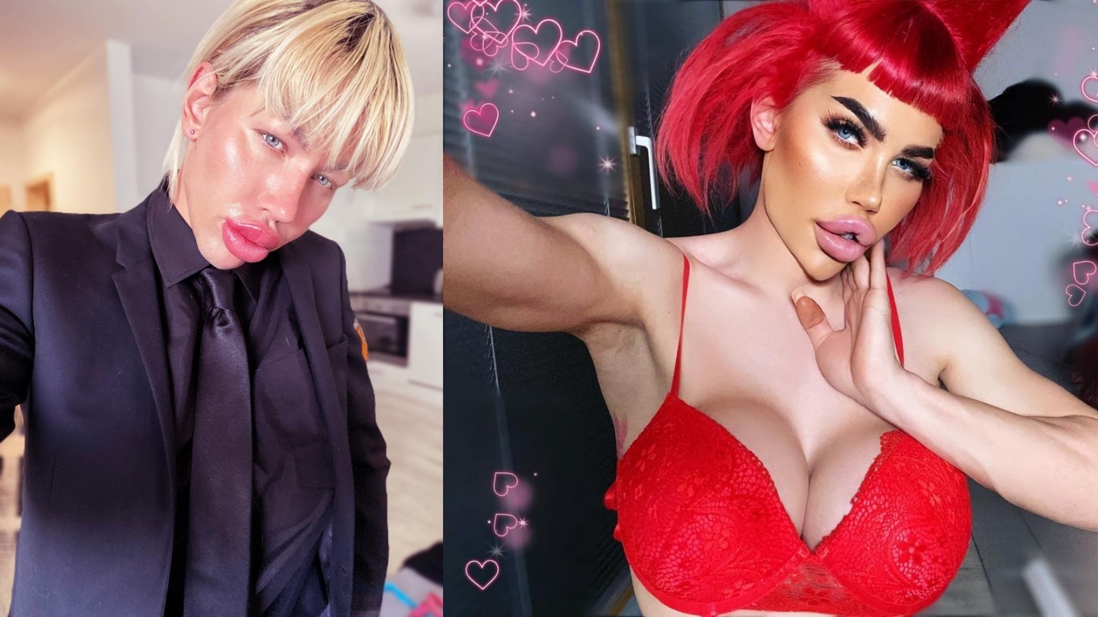 Bratzdoll Honza Šimša z Brna ví, že krása bolí. Kromě toho ho dokonce okradl plastický chirurg