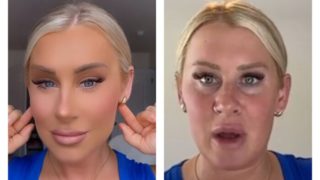 GALERIE: Několik příkladů šílených vzhledových úprav, kterými se lidé chlubí na&nbsp;sociálních sítích