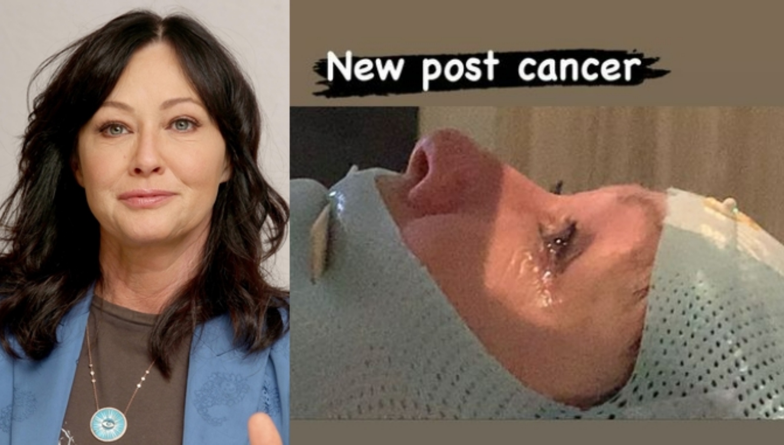 Špatné zprávy pro nemocnou ale statečnou Shannen Doherty. Rakovina se rozšířila do mozku.