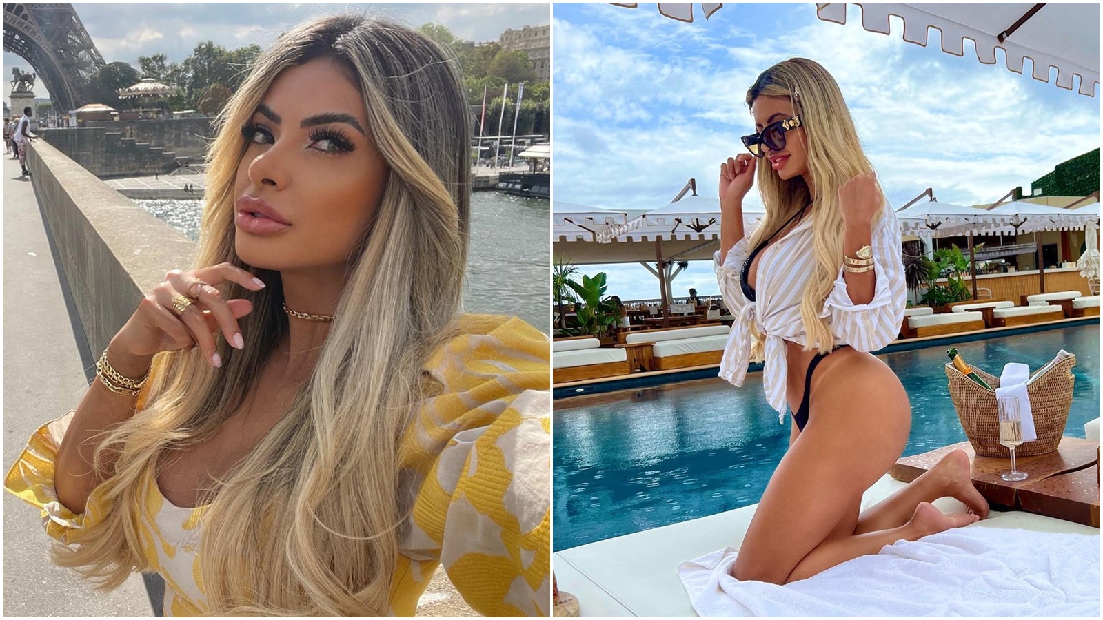 Takhle podle Playboye vypadá dokonalá žena. Brazilka po&nbsp;zvolení přiznala desítky zákroků