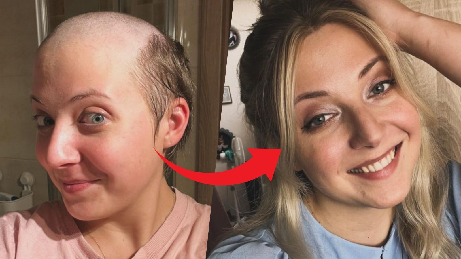 Slováčková v slzách: Konečně jsem našla kvalitní paruku a&nbsp;cítím se dobře