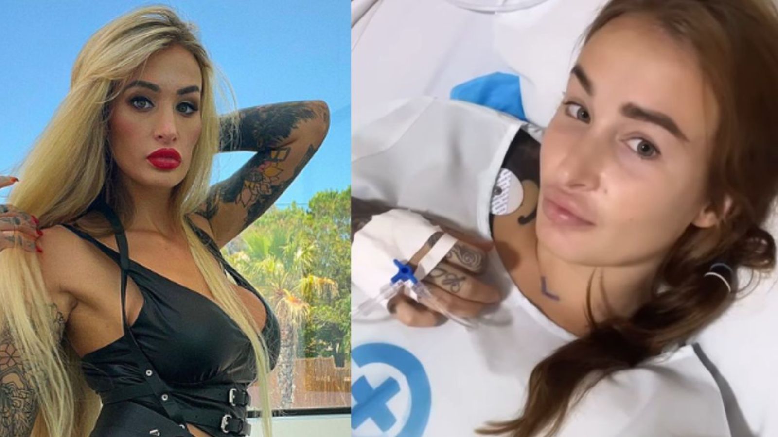 V ohrožení života kvůli silikonům! Za vyndání zaplatila bývalá pornoherečka 80 000 Kč