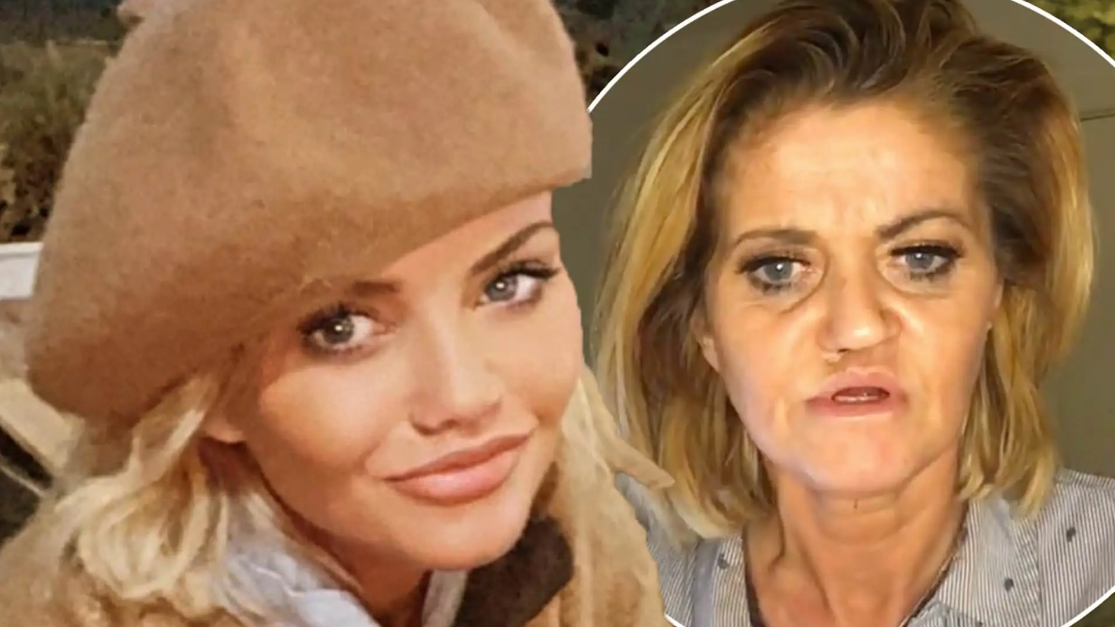 Drogy jí zničily nos, ale nevzdává se: Herečka Danniella Westbrook po&nbsp;plastice plánuje návrat