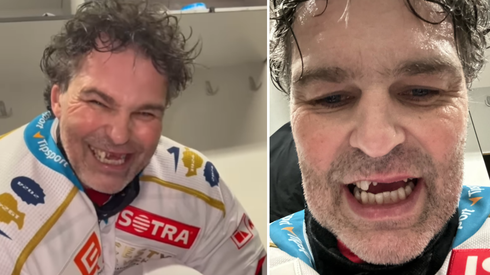 Jaromír Jágr přišel o&nbsp;zuby: Legendární hokejista bere situaci nejen s&nbsp;nadhledem, ale také s&nbsp;úsměvem