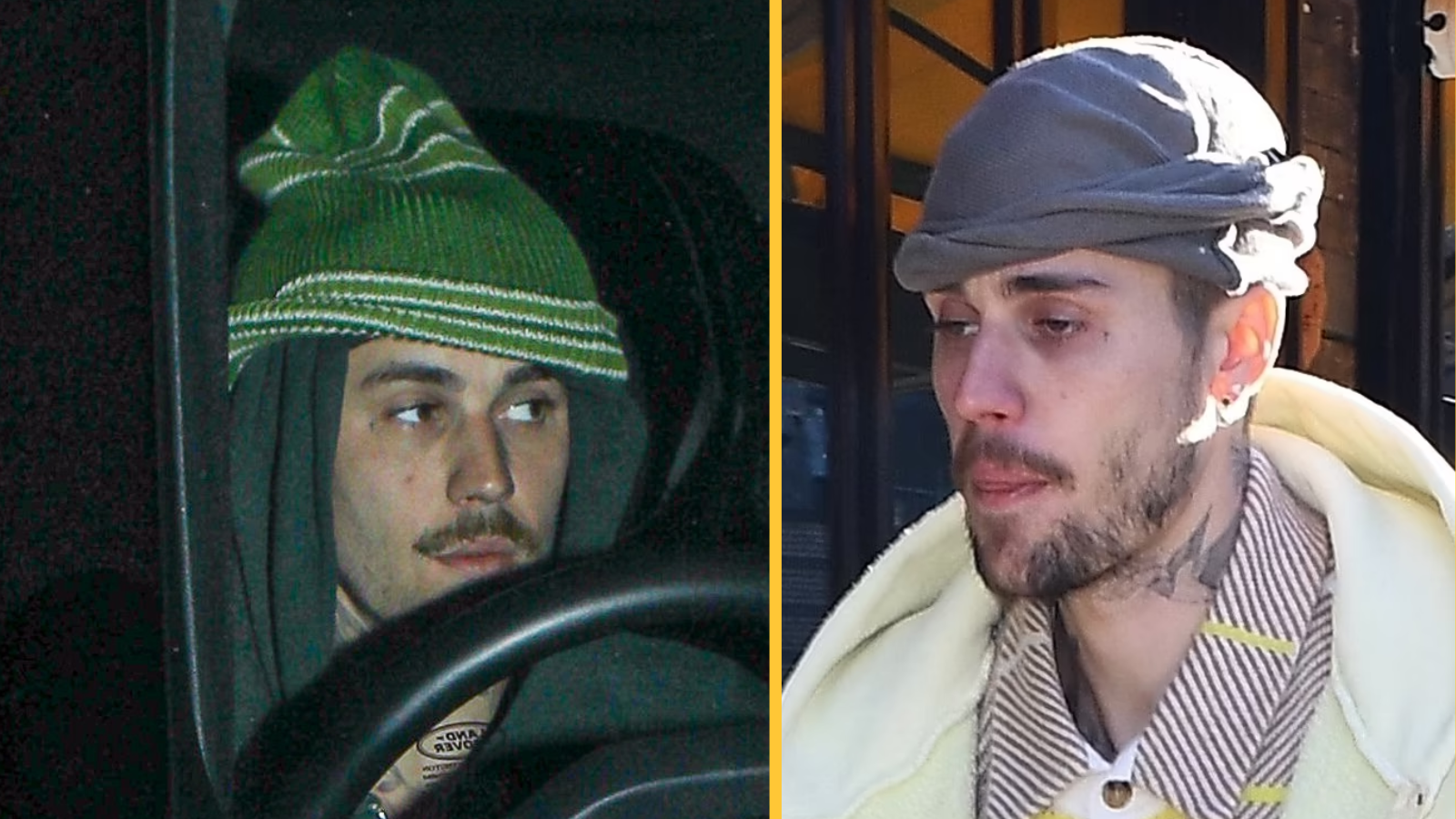Justin Bieber vyvrací spekulace o drogách: Pravda o jeho unaveném vzhledu