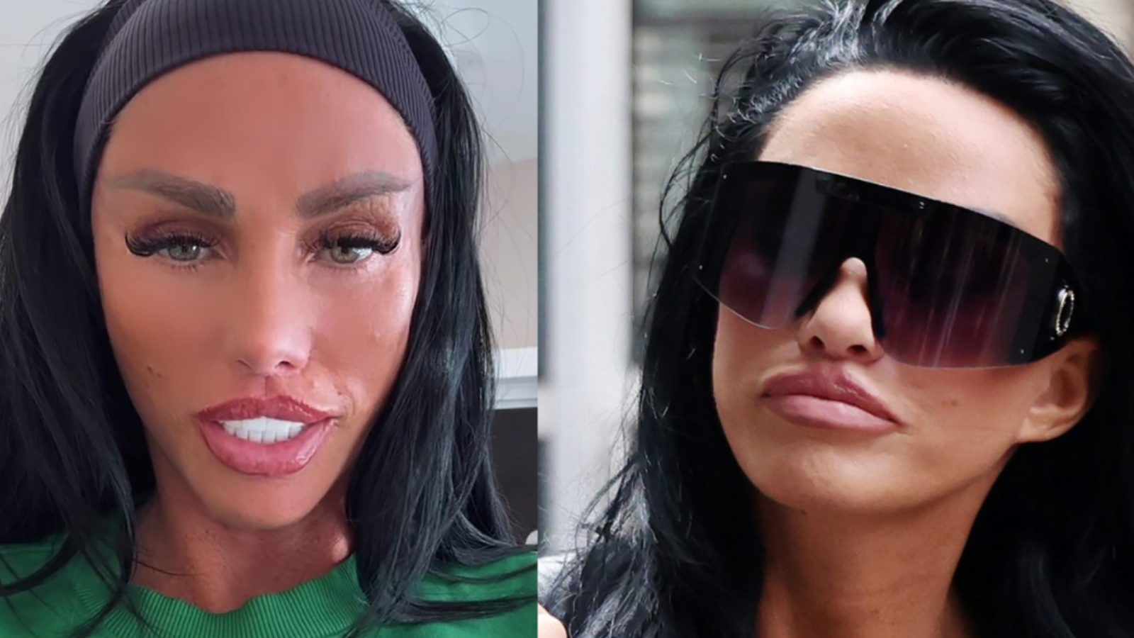 Katie Price je po dalších zákrocích k nepoznání. Fanoušci se o ni bojí