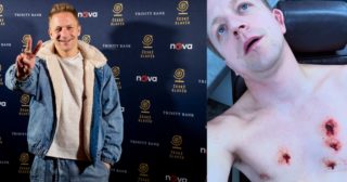 Tomáš Klus vyděsil fanoušky. Sdílel děsivou fotografii