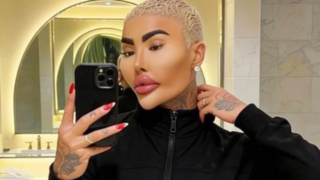 Král rtů nalezen mrtvý. Policie řeší možnou souvislost s&nbsp;kosmetickým zákrokem