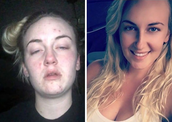 10 fascinujících proměn lidí, kteří po letech přestali brát drogy. GALERIE