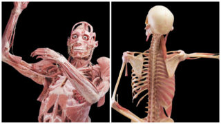 KOMENTÁŘ: Proč by měl jít každý na&nbsp;výstavu lidských těl, a&nbsp;proč je protest proti ní návrat do středověku