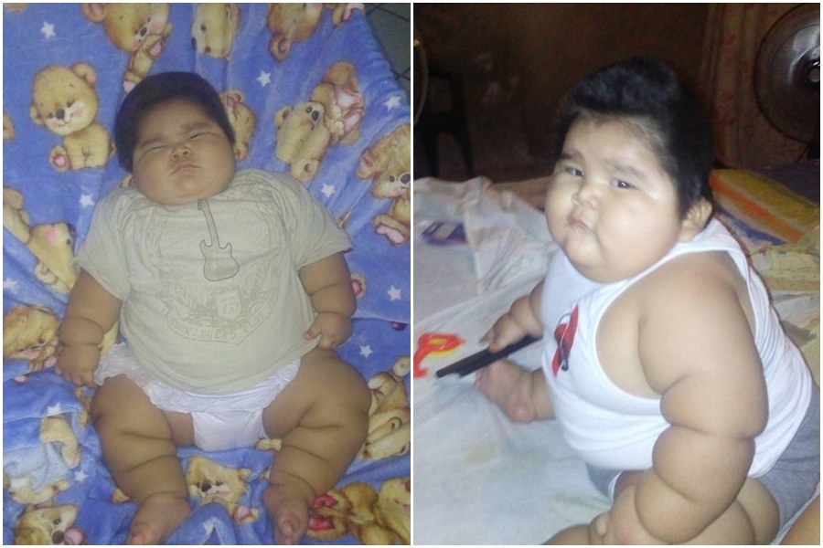 GALERIE: Nejtlustší chlapec na&nbsp;světě trpí vzácným syndromem. V&nbsp;necelém roce váží 30&nbsp;kg
