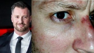 FOTO: Petr Vágner se zranil! Víme, co se stalo