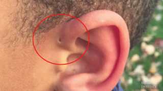 Nemáte na&nbsp;uchu tuhle dírku? Biolog odhalil, o&nbsp;jakou vzácnost jde