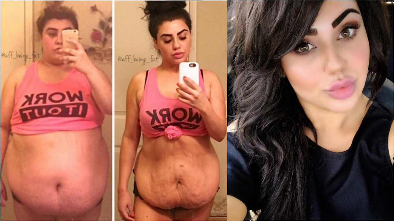 Neuvěřitelná proměna! Dívka zhubla 60 kilo, protože se za ni styděli i vlastní rodiče
