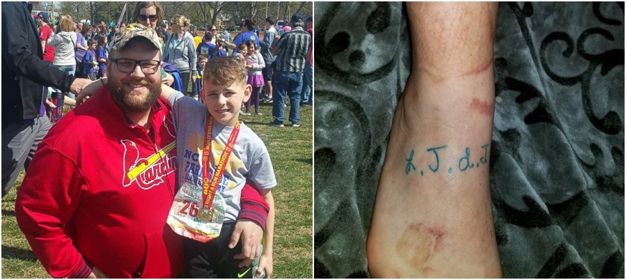 Táta roku. Muž si nechal vytetovat jizvy, aby podpořil syna po&nbsp;úrazu