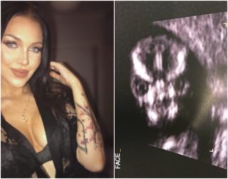 Démon! Maminka zveřejnila fotku z&nbsp;ultrazvuku, dočkala se nenávistných komentářů